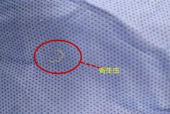 成都华厦眼科张学进博士提醒爱狗人士要预防